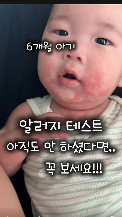 스푼타임 알러지키트 공구